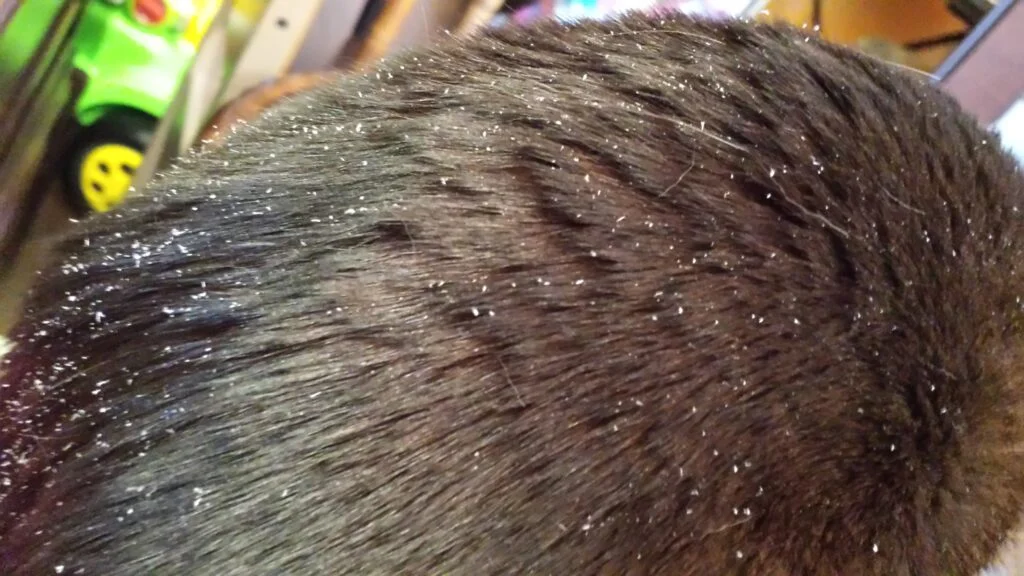 Cat dandruff due to change of coat