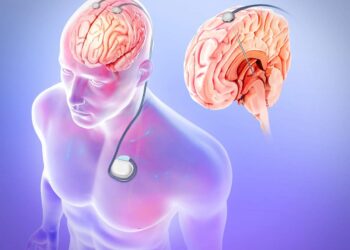 Vagus Nerve Stimulation