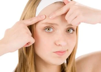 Sun and pimples ; Fighting pimples 7 Fighting pimples