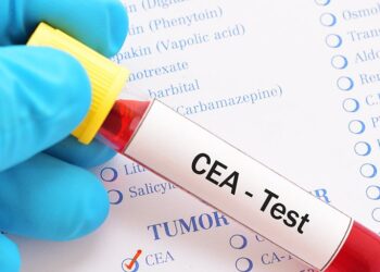 CEA Test: Understanding Carcinoembryonic Antigen (CEA) Levels 3 CEA Test