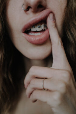 Does It Hurt to Get Braces? A Quick Guide 2 Crop woman with teeth retainers lifting upper lip with finger