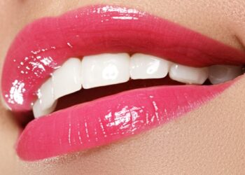 How Long Do Dental Implants Last